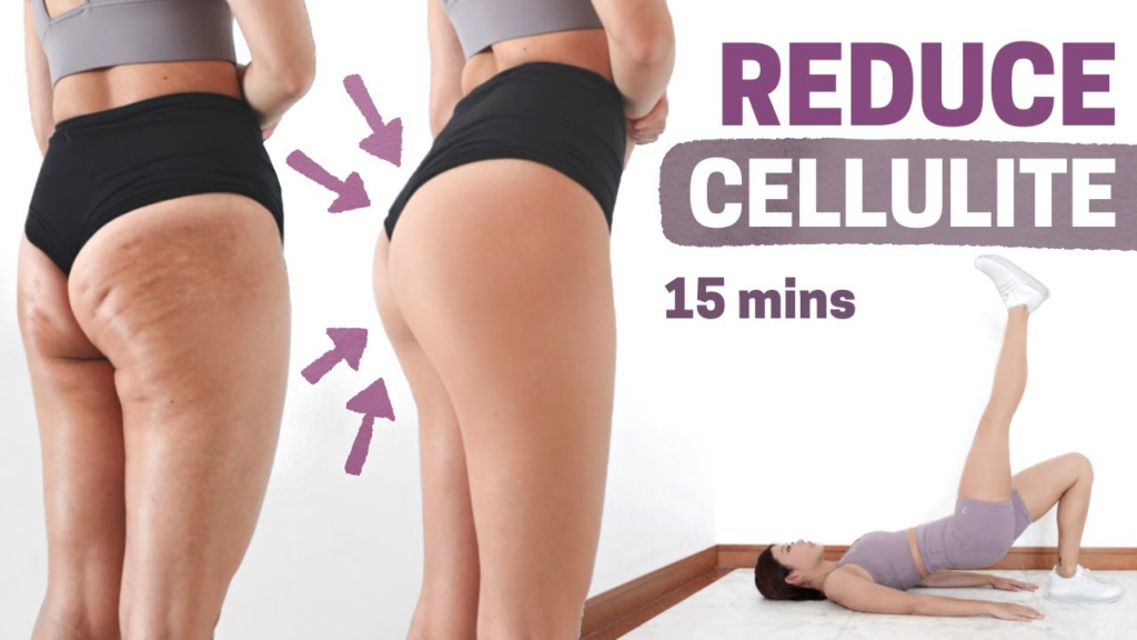 how to get rid of cellulite
